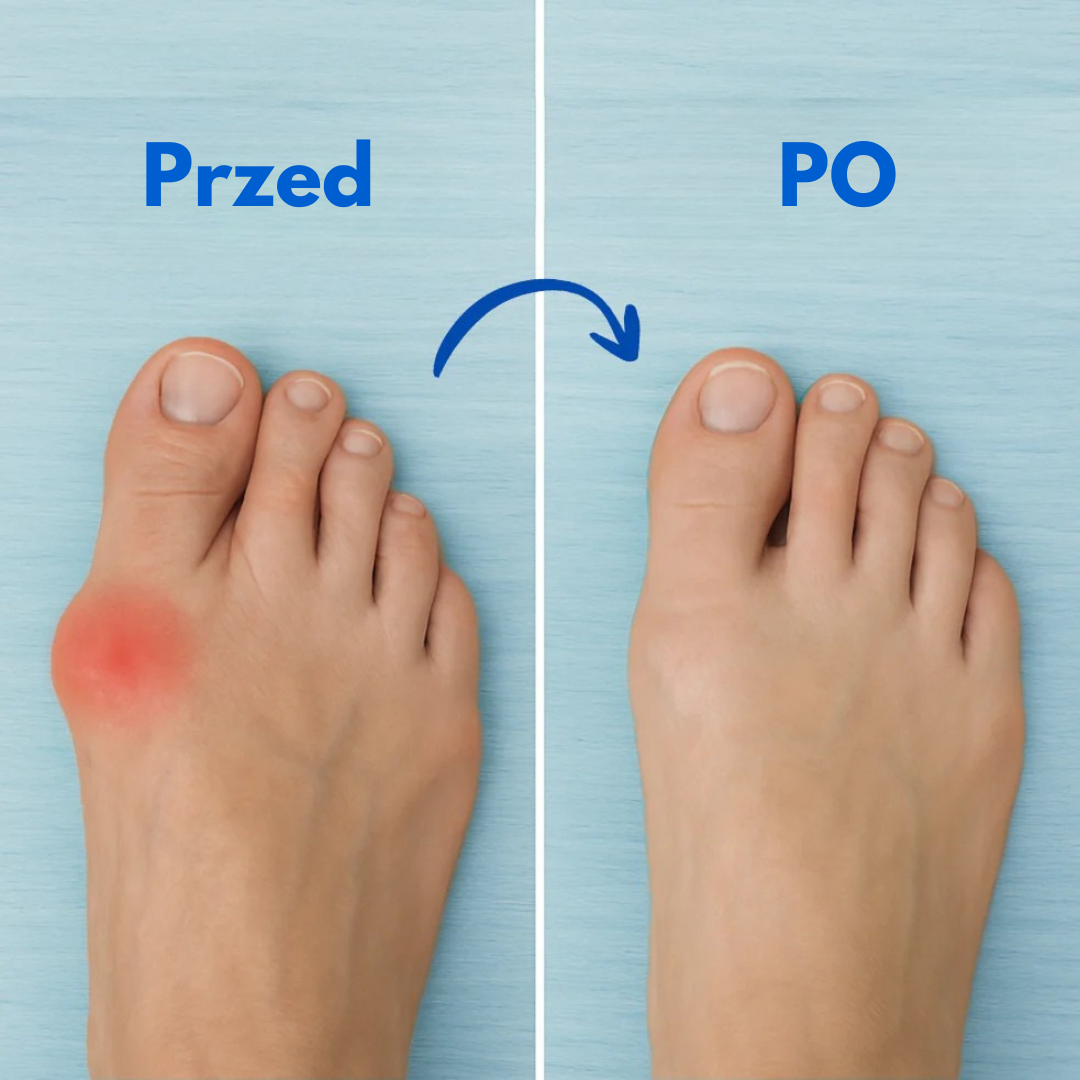 Recovery™ - Orteza Ortopedyczna na Haluksy